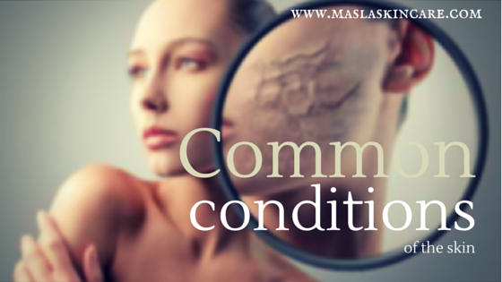 Common Skin Conditions.